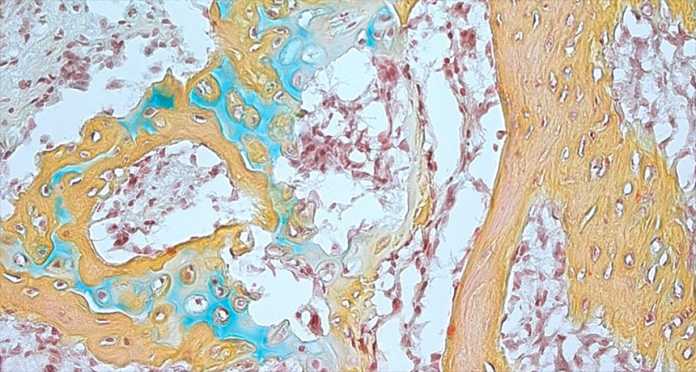 科学家发现帮助骨骼和软骨生长的干细胞