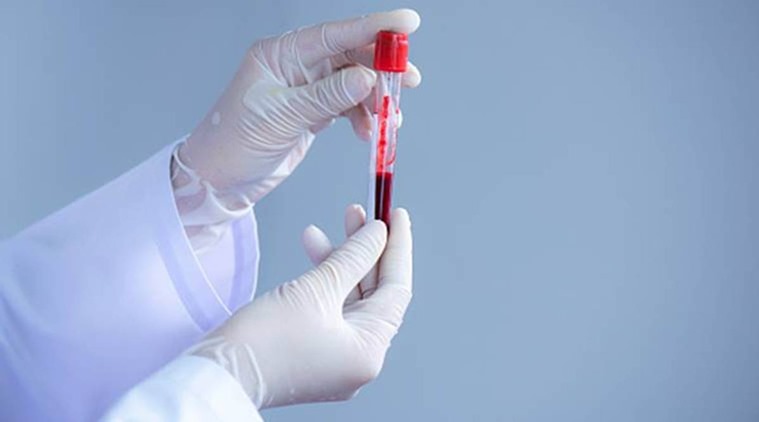 马哈拉施特拉邦政府，血浆试验，